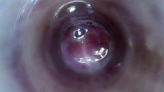 Look Inside My Penis Endoscope With Test Tube Introducing Cam Deep Into Penis