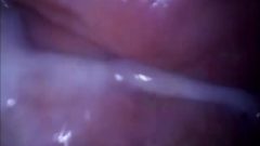 Girl Orgasm Filmed From Inside Vagina