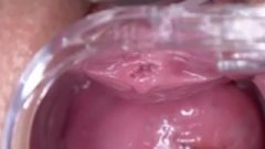 Brunette Woman (speculum, Rubber Toy And Orgasm)