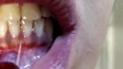 Mouth, Uvula, Tongue, Teeth Checks And Endoscope (short Scene)