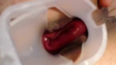 Anal Speculum And Orgasm Show From Butt