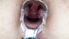 Brutal Anal Banging And Speculum Opening My Asshole Wide While I Sperm