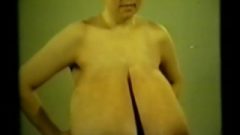 Russian Massive Breasts Macromastia